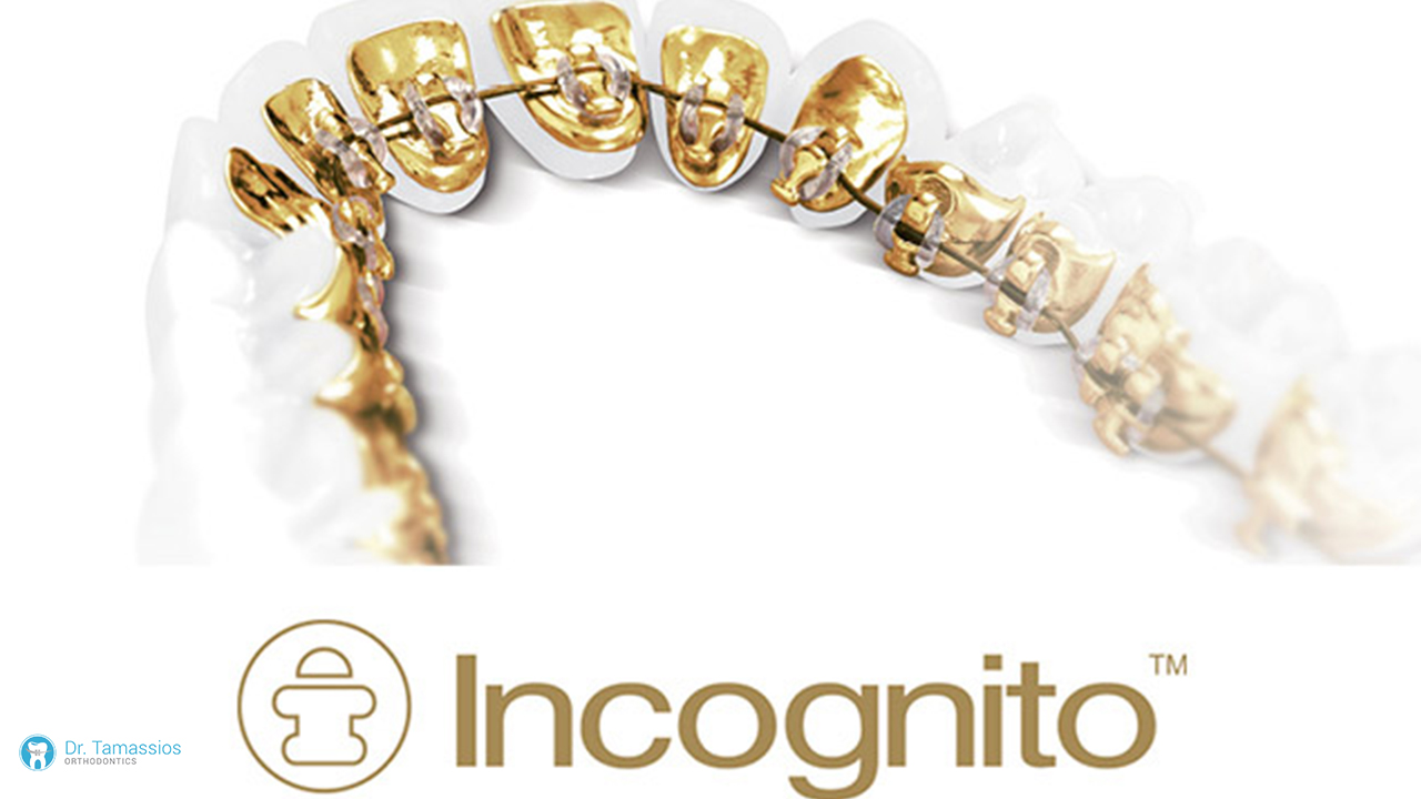 Orthodontics Nicosia